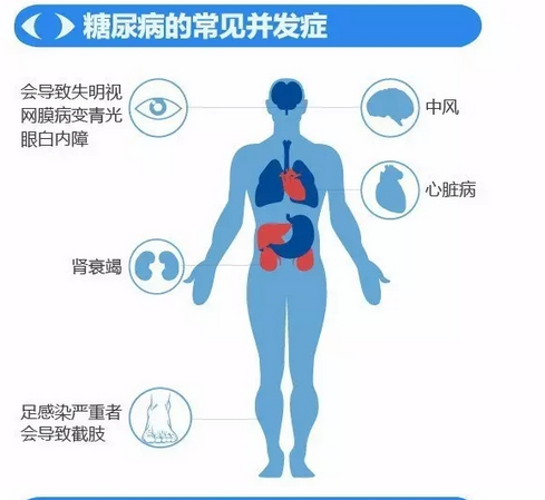 你造嗎？糖尿病晚期眼睛會(huì)致盲！