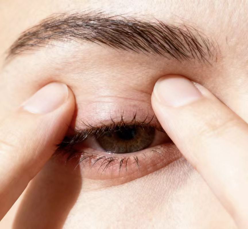 冬季干眼高發(fā)，久治不愈或是睫毛上的螨蟲在作祟！